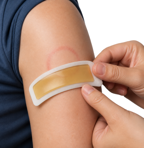 RECOVERY PATCH-  דבש רפואי והידרוג'ל לטיפול בפצעי סוכרת