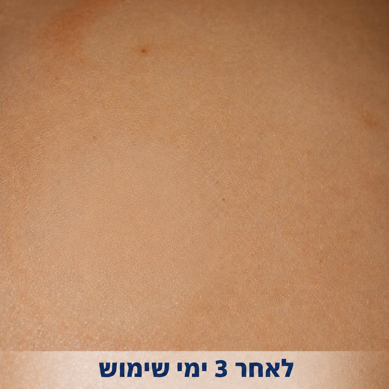 לאחר 3 ימי שימוש